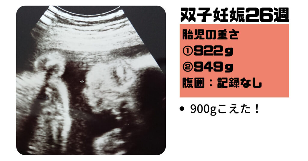 【双子妊娠7ヵ月（24週～27週）】里帰り出産のために大移動